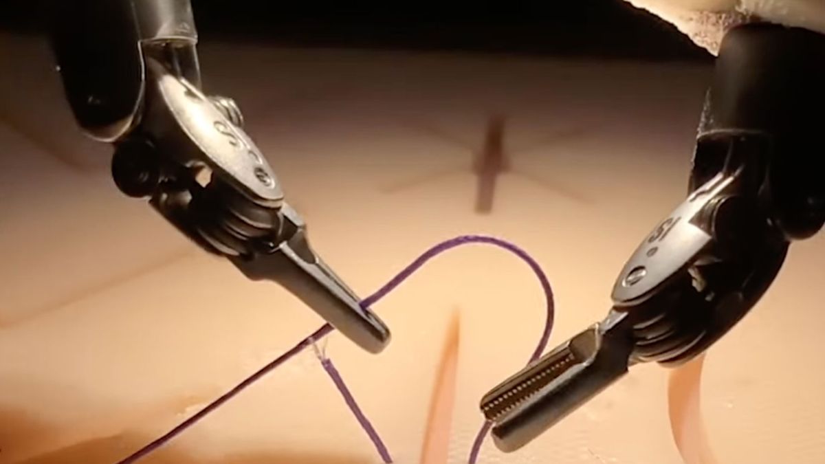 AI robot trained by watching videos to perform surgeries.